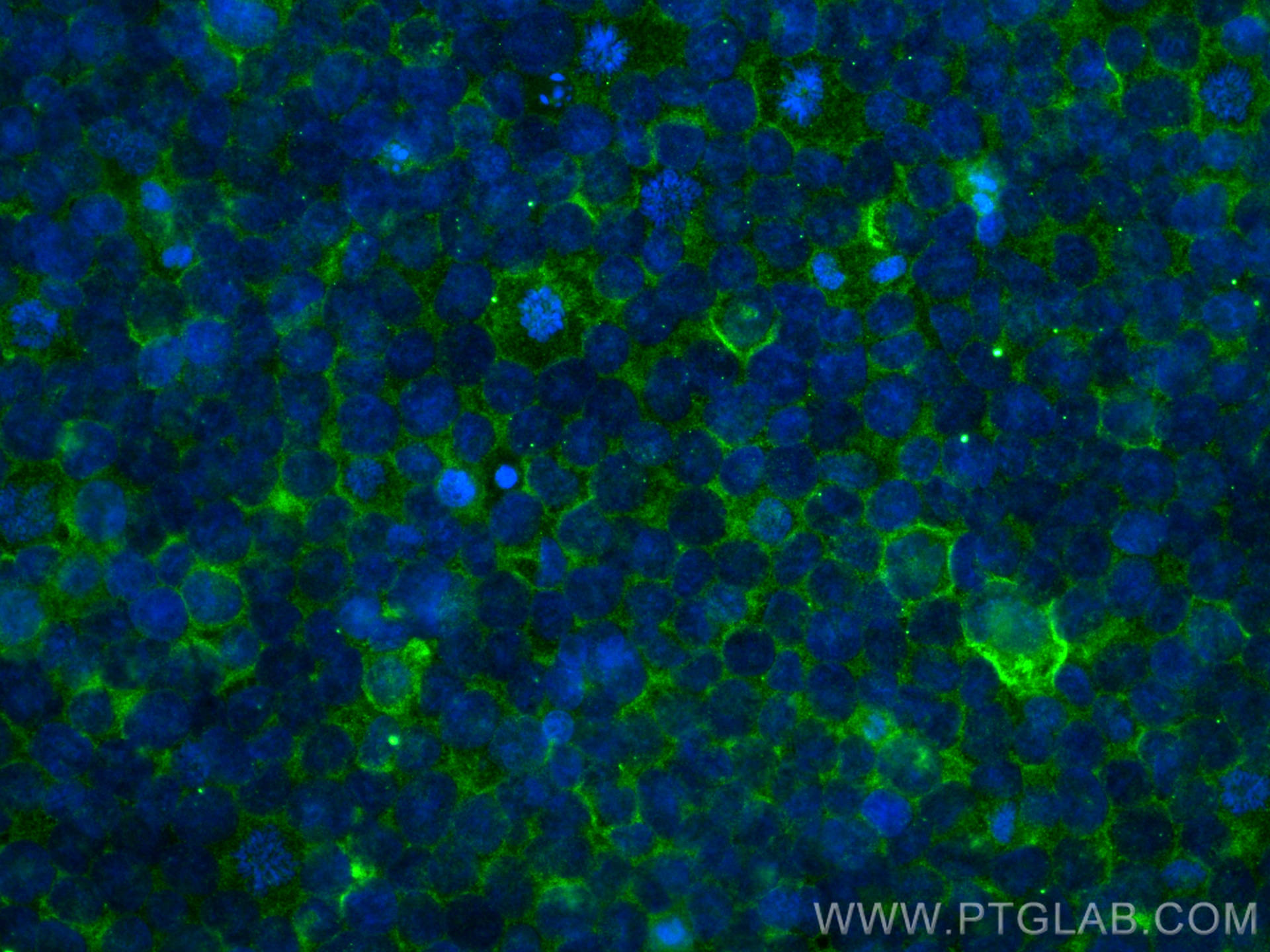 Immunofluorescence (IF) / fluorescent staining of THP-1 cells using CD13 Monoclonal antibody (66211-1-Ig)