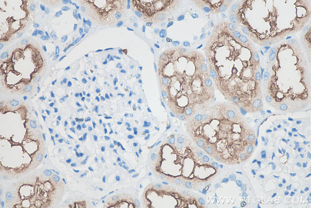 Immunohistochemistry (IHC) staining of human kidney tissue using CD13 Monoclonal antibody (66211-1-Ig)