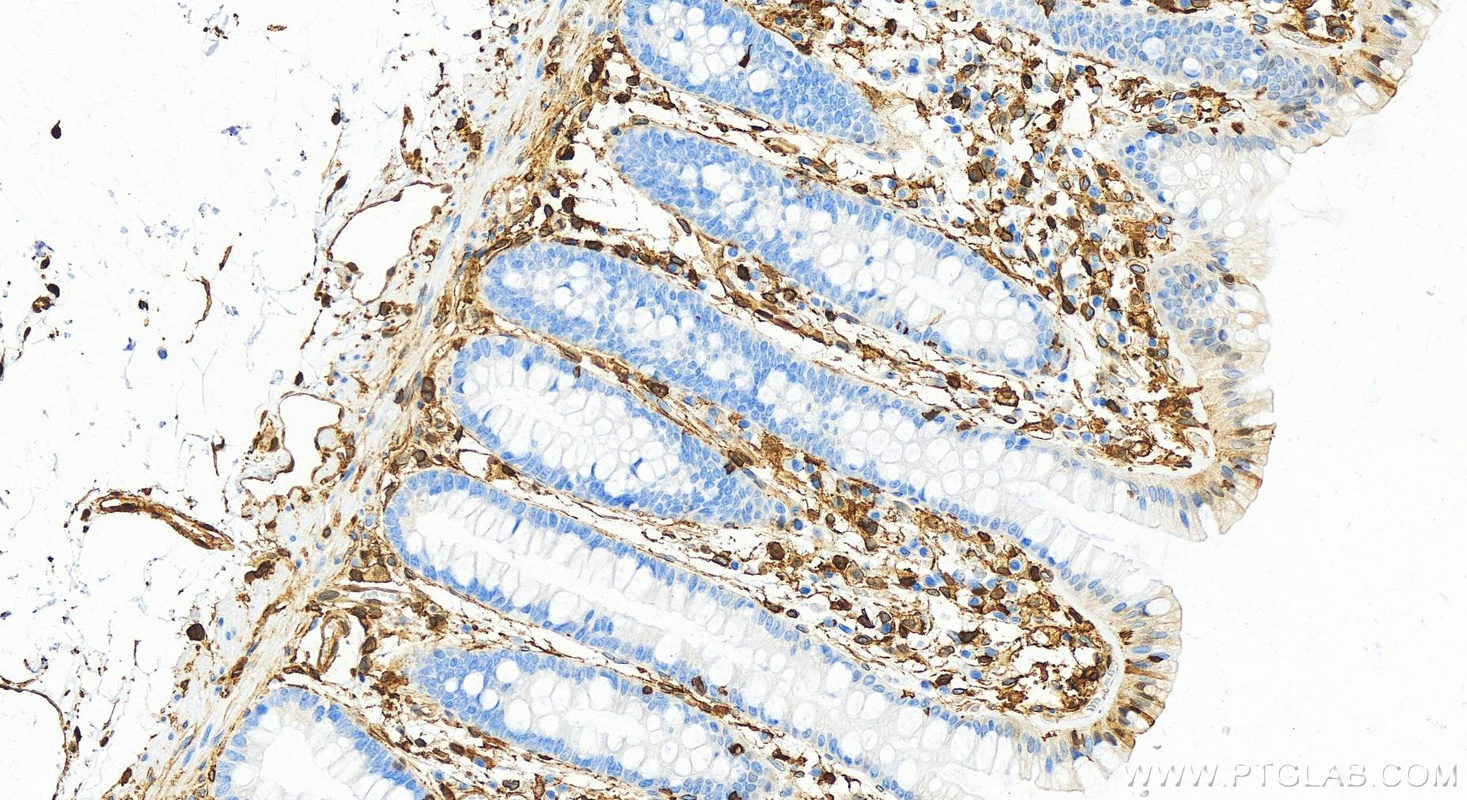 Immunohistochemistry (IHC) staining of human colon tissue using Annexin A1 Polyclonal antibody (21990-1-AP)