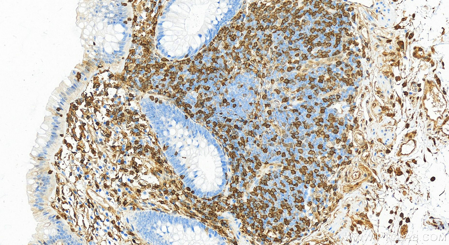 Immunohistochemistry (IHC) staining of human colon tissue using Annexin A1 Polyclonal antibody (21990-1-AP)