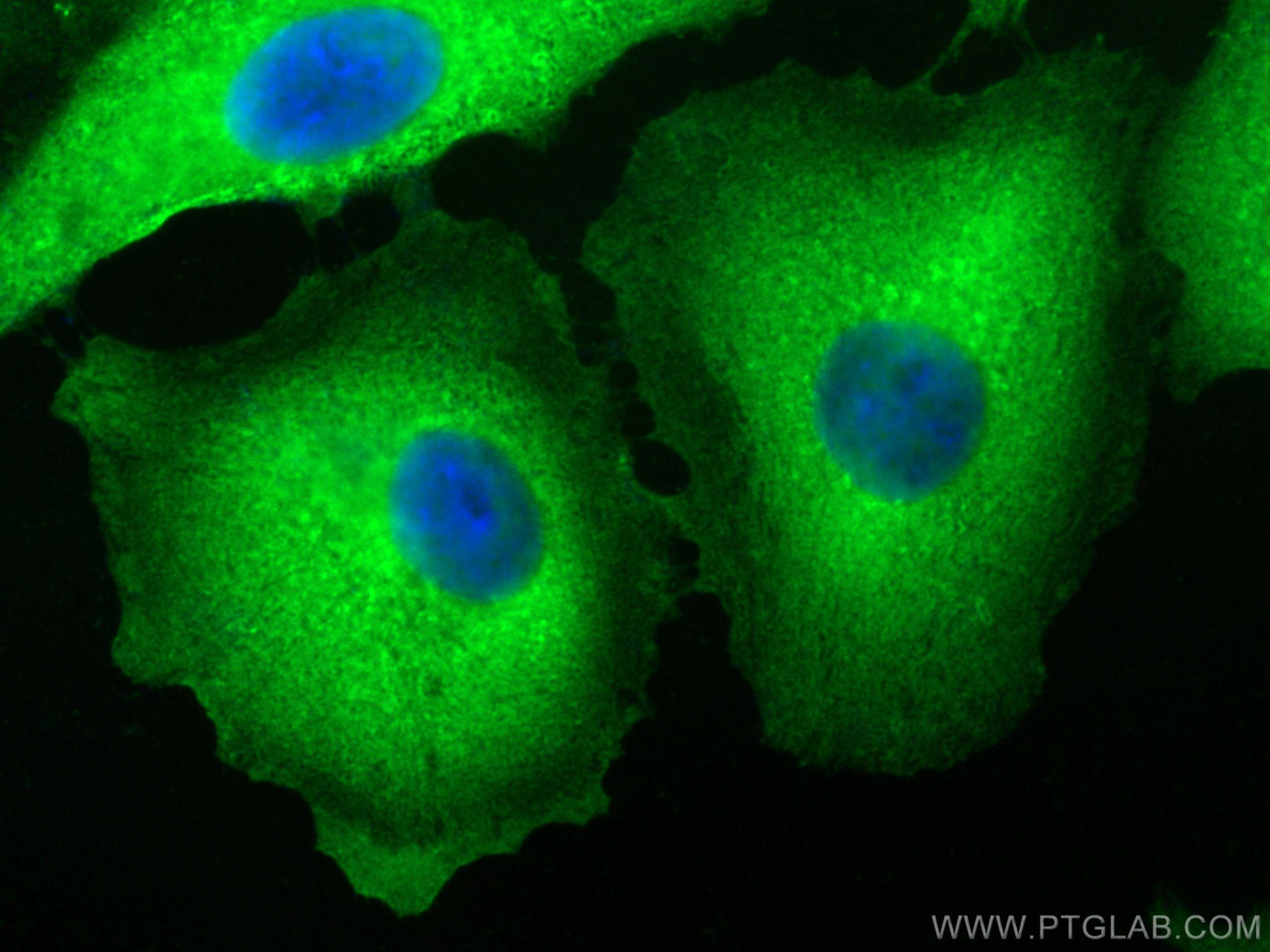 Immunofluorescence (IF) / fluorescent staining of A549 cells using Annexin A1 Polyclonal antibody (21990-1-AP)