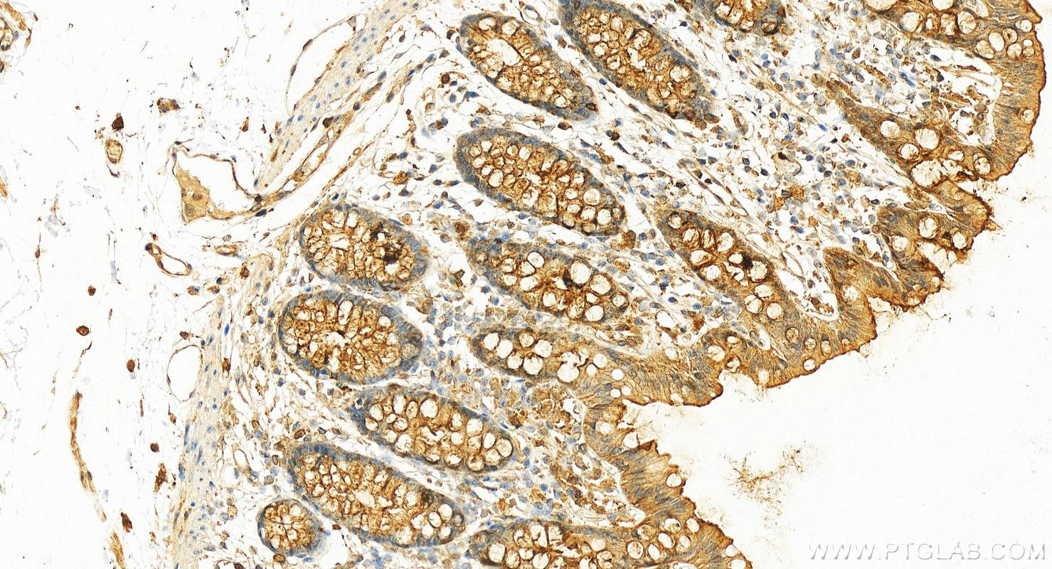 Immunohistochemistry (IHC) staining of human colon tissue using Annexin A1 Polyclonal antibody (55018-1-AP)