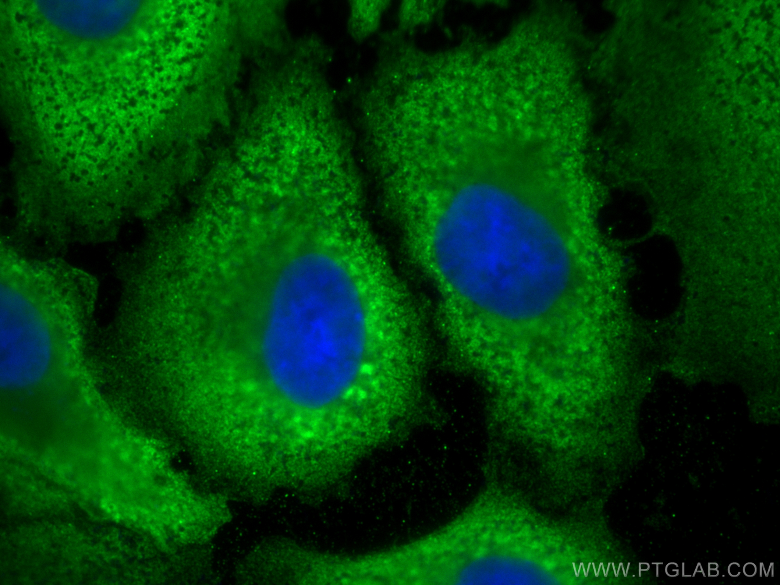 Immunofluorescence (IF) / fluorescent staining of A549 cells using Annexin A1 Monoclonal antibody (66344-1-Ig)