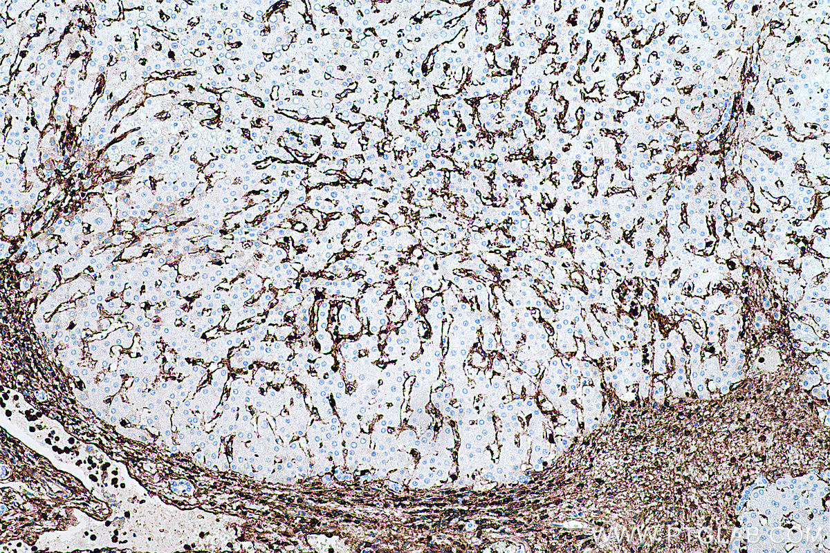 Immunohistochemistry (IHC) staining of human liver tissue using Annexin A1 Monoclonal antibody (66344-1-Ig)