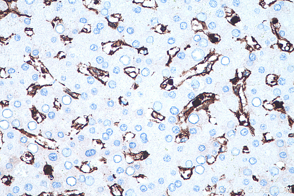 Immunohistochemistry (IHC) staining of human liver tissue using Annexin A1 Monoclonal antibody (66344-1-Ig)