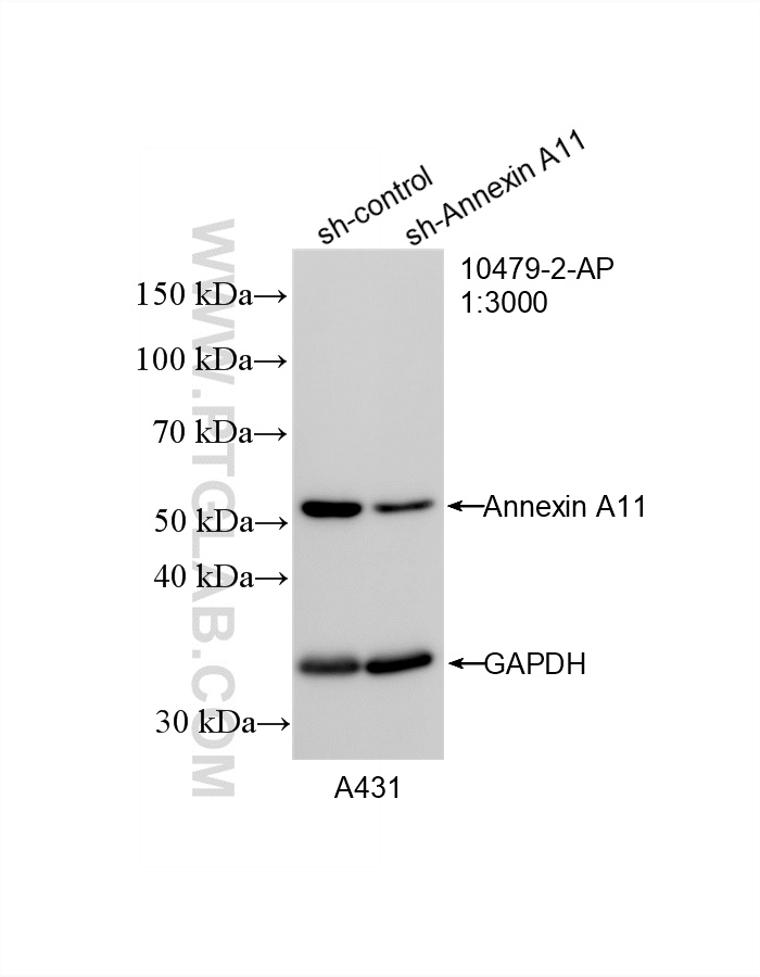 Western Blot (WB) analysis of A431 cells using Annexin A11 Polyclonal antibody (10479-2-AP)
