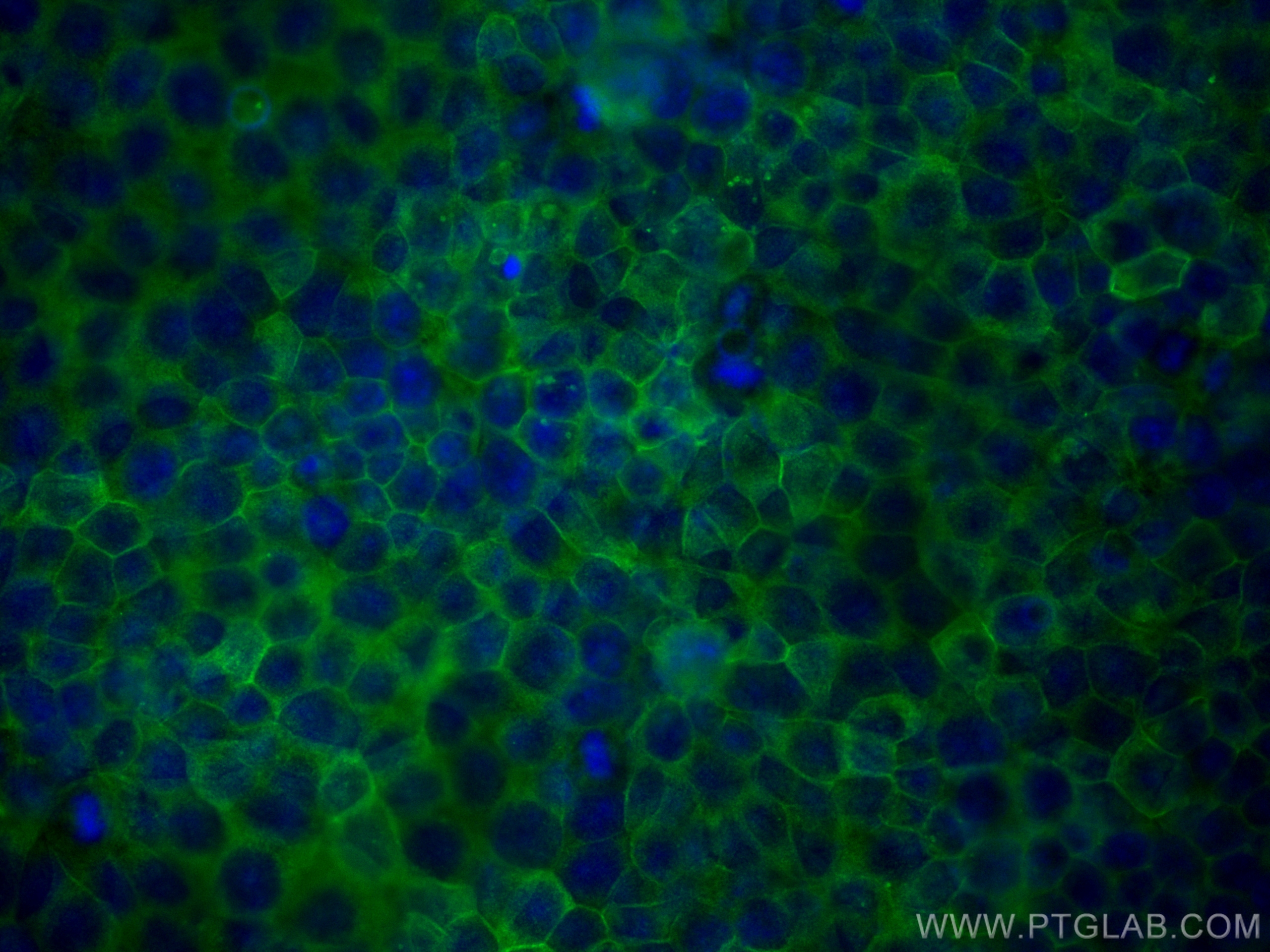 Immunofluorescence (IF) / fluorescent staining of MCF-7 cells using Annexin A2 Polyclonal antibody (11256-1-AP)