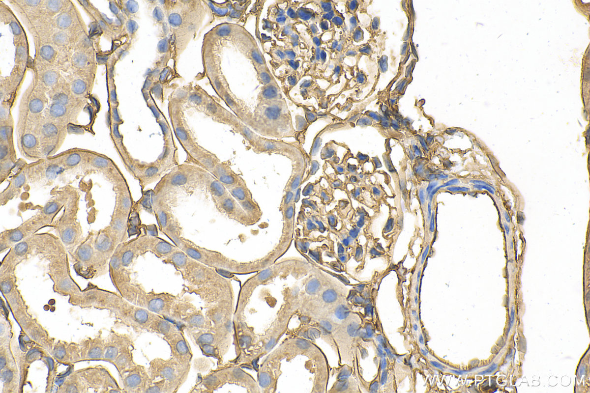 Immunohistochemistry (IHC) staining of mouse kidney tissue using Annexin A2 Polyclonal antibody (11256-1-AP)