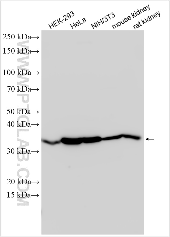 Western Blot (WB) analysis of various lysates using Annexin A2 Polyclonal antibody (11256-1-AP)