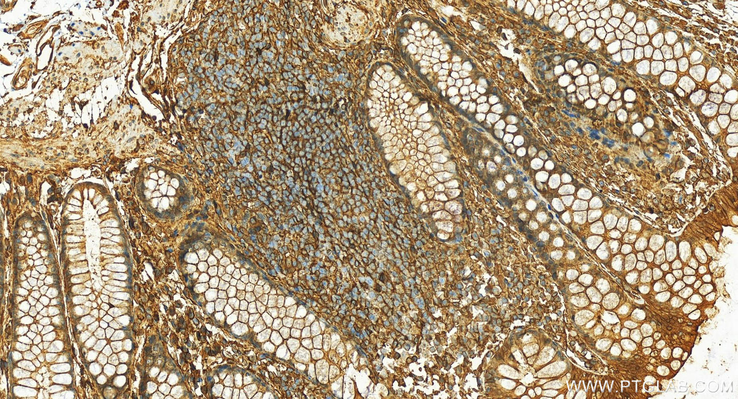 Immunohistochemistry (IHC) staining of human colon tissue using Annexin A4 Polyclonal antibody (10087-1-AP)