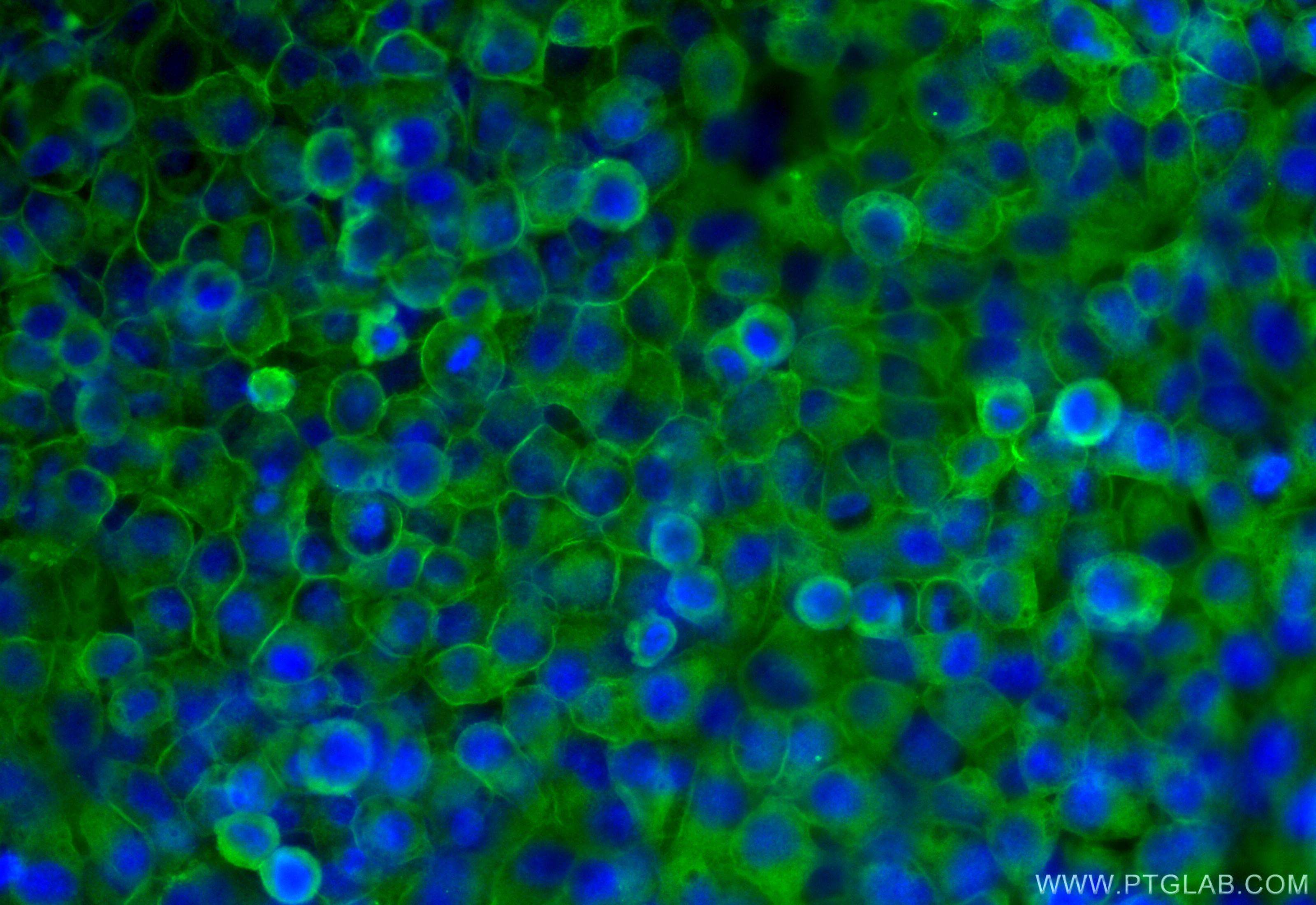 Immunofluorescence (IF) / fluorescent staining of HeLa cells using Annexin V Polyclonal antibody (11060-1-AP)