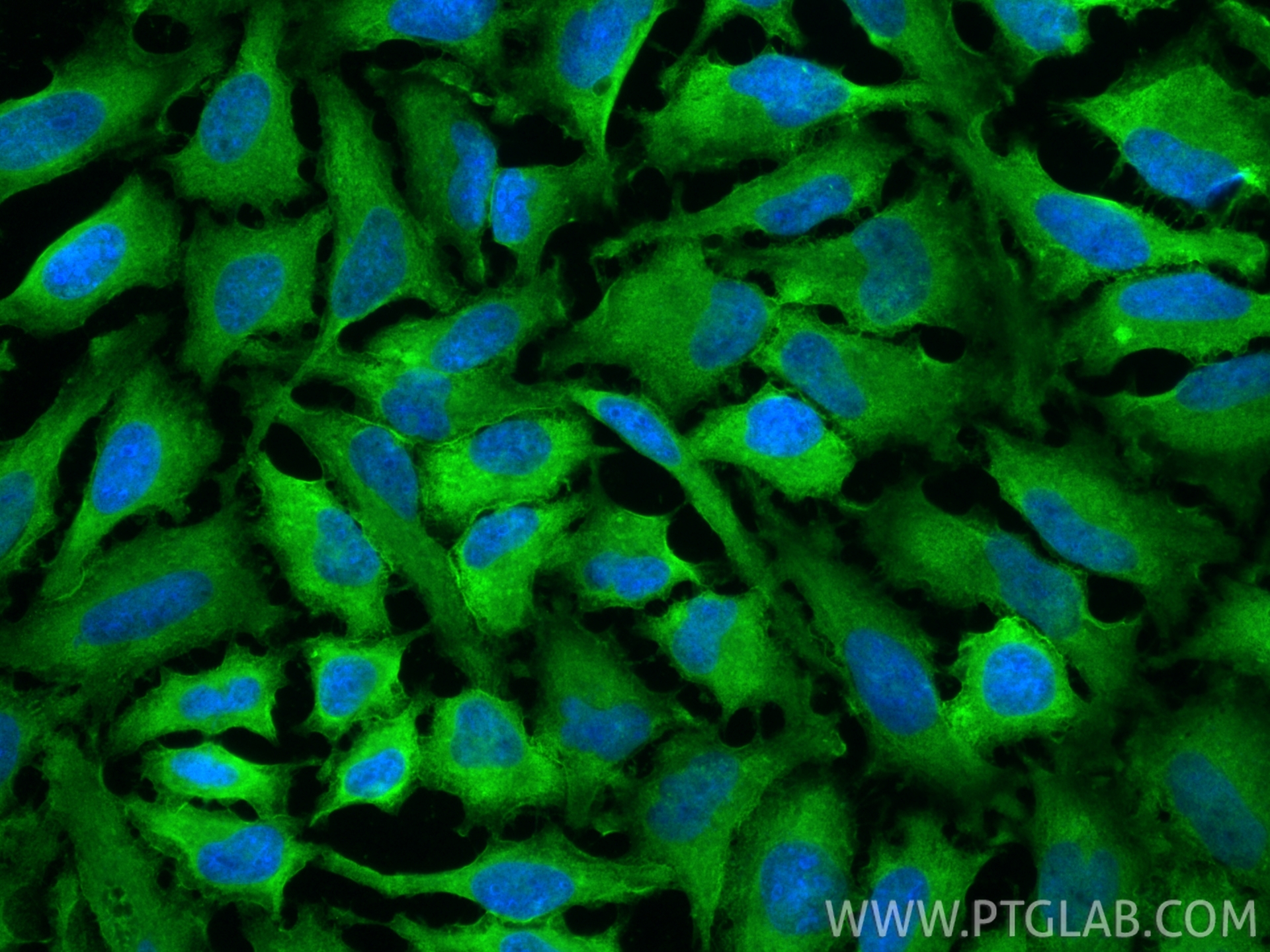 Immunofluorescence (IF) / fluorescent staining of HeLa cells using Annexin V Polyclonal antibody (11060-1-AP)