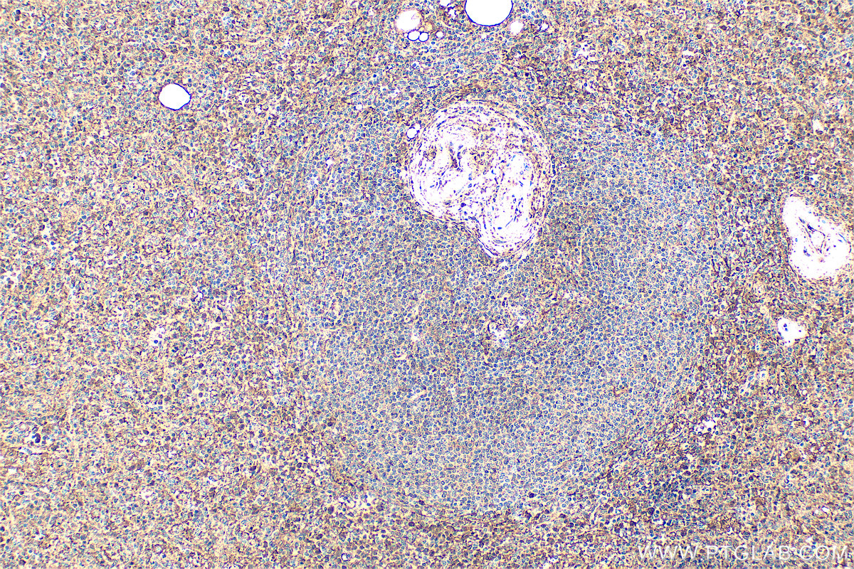 Immunohistochemistry (IHC) staining of human spleen tissue using Annexin V Polyclonal antibody (11060-1-AP)