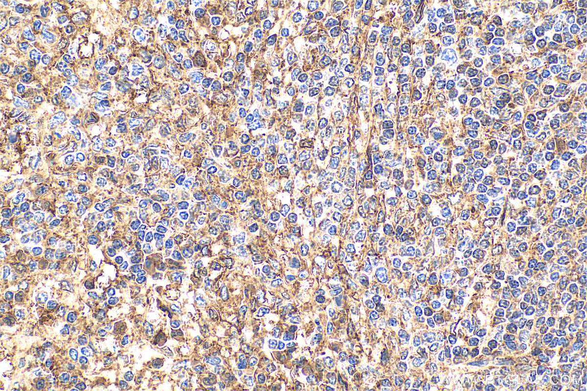 Immunohistochemistry (IHC) staining of human spleen tissue using Annexin V Polyclonal antibody (11060-1-AP)