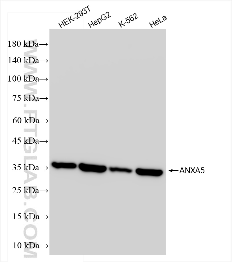 Western Blot (WB) analysis of various lysates using ANXA5 Recombinant antibody (83929-1-RR)