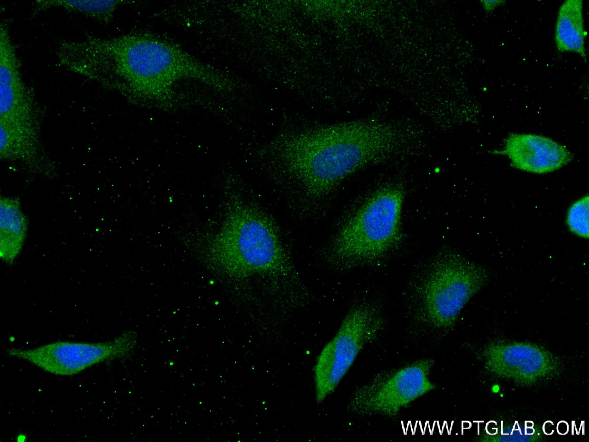 Immunofluorescence (IF) / fluorescent staining of HeLa cells using ANXA5 Recombinant antibody (83929-2-RR)