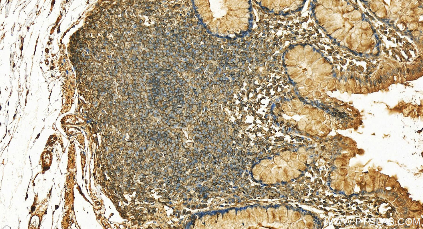 Immunohistochemistry (IHC) staining of human normal colon using Annexin VI Polyclonal antibody (12542-1-AP)