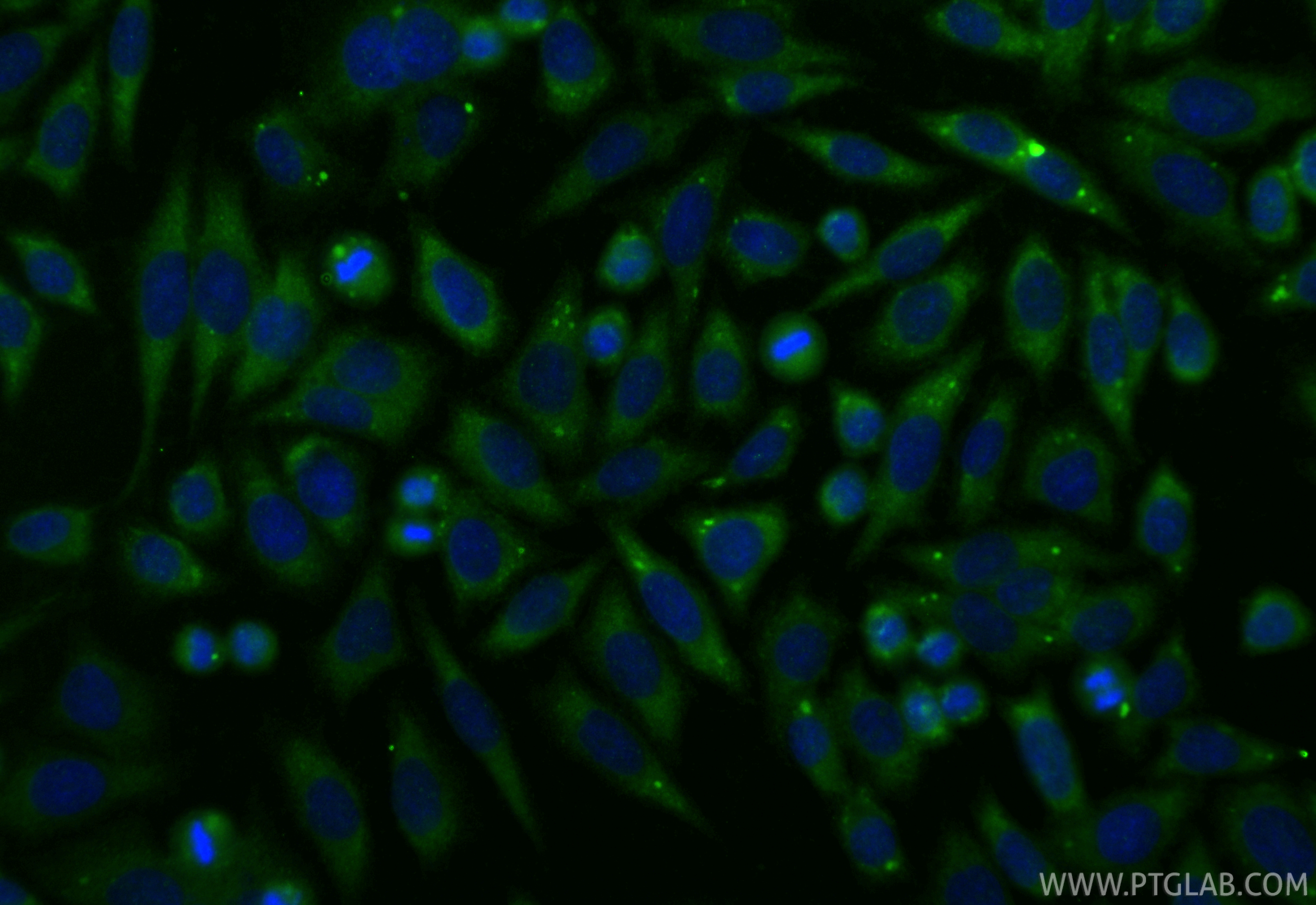 Immunofluorescence (IF) / fluorescent staining of HepG2 cells using Annexin VI Polyclonal antibody (12542-1-AP)
