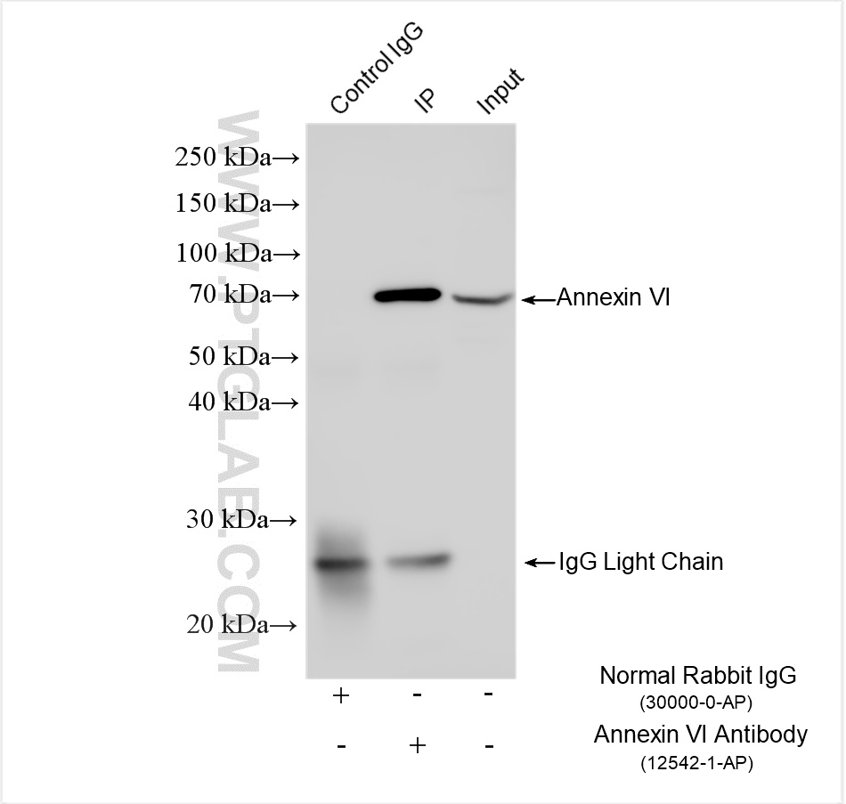 Immunoprecipitation (IP) experiment of HeLa cells using Annexin VI Polyclonal antibody (12542-1-AP)
