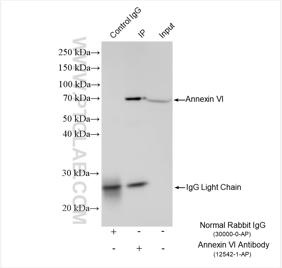 Immunoprecipitation (IP) experiment of mouse kidney tissue using Annexin VI Polyclonal antibody (12542-1-AP)