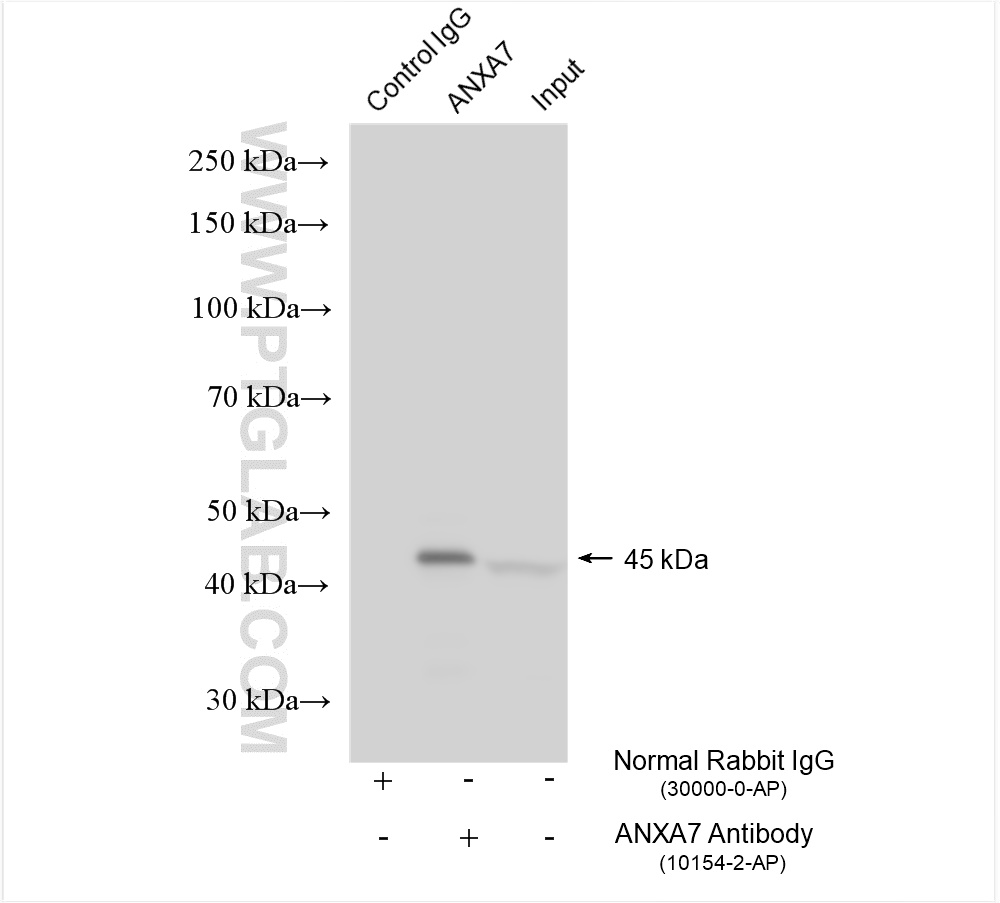 Immunoprecipitation (IP) experiment of RAW 264.7 cells using Annexin A7  Polyclonal antibody (10154-2-AP)