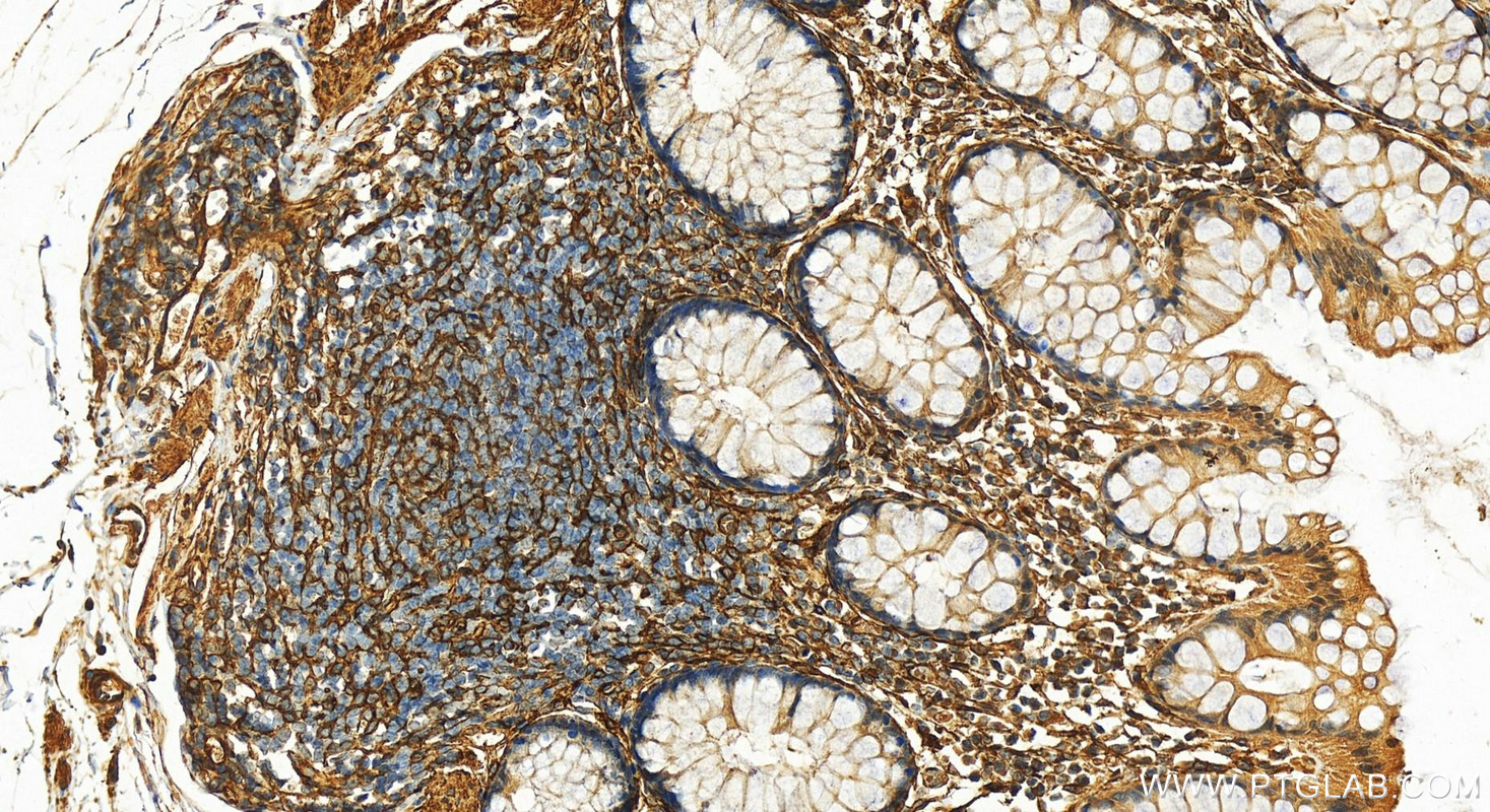 Immunohistochemistry (IHC) staining of human colon tissue using VAP1 Polyclonal antibody (14365-1-AP)