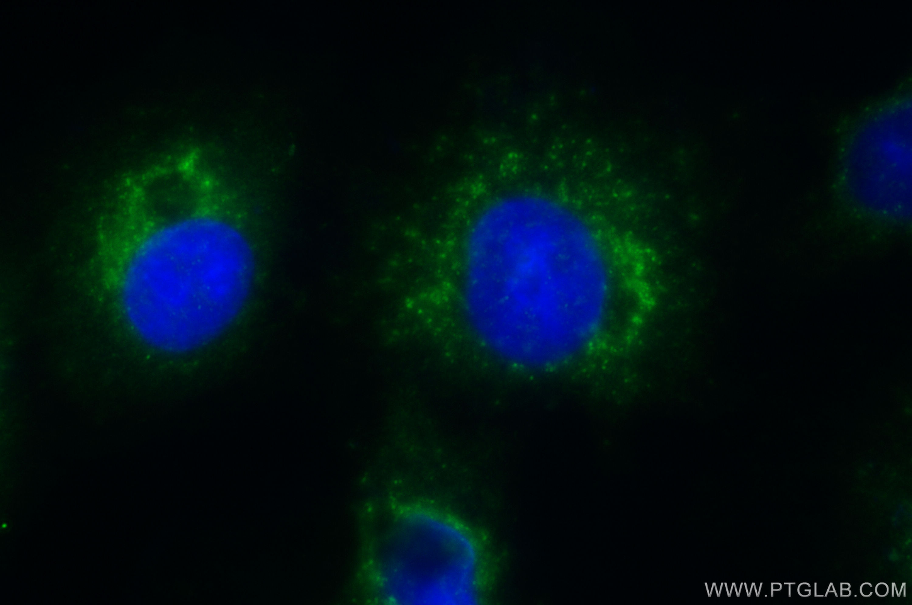 Immunofluorescence (IF) / fluorescent staining of A549 cells using ACOX1 Polyclonal antibody (10957-1-AP)