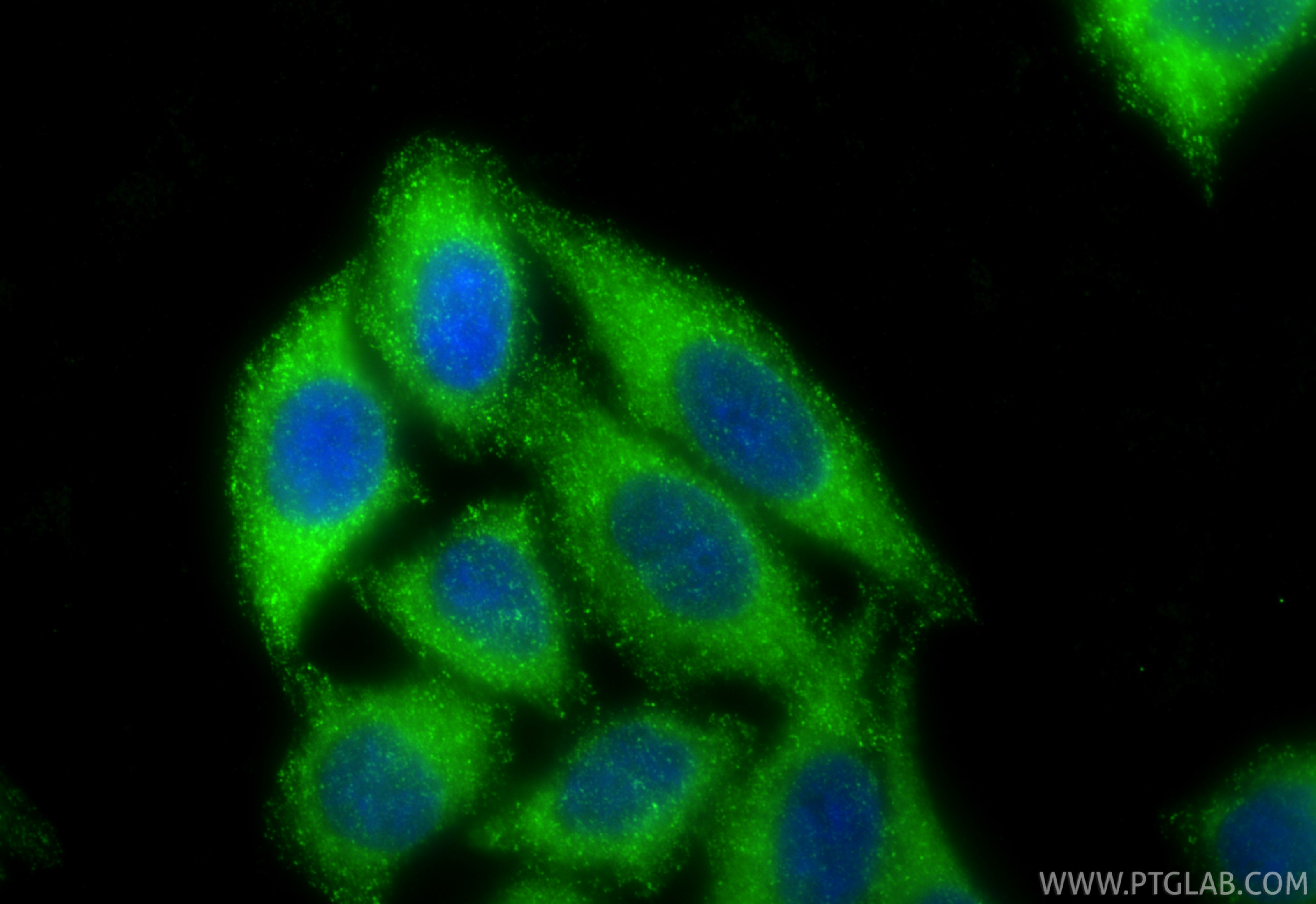 Immunofluorescence (IF) / fluorescent staining of HepG2 cells using AP1B1 Polyclonal antibody (16932-1-AP)