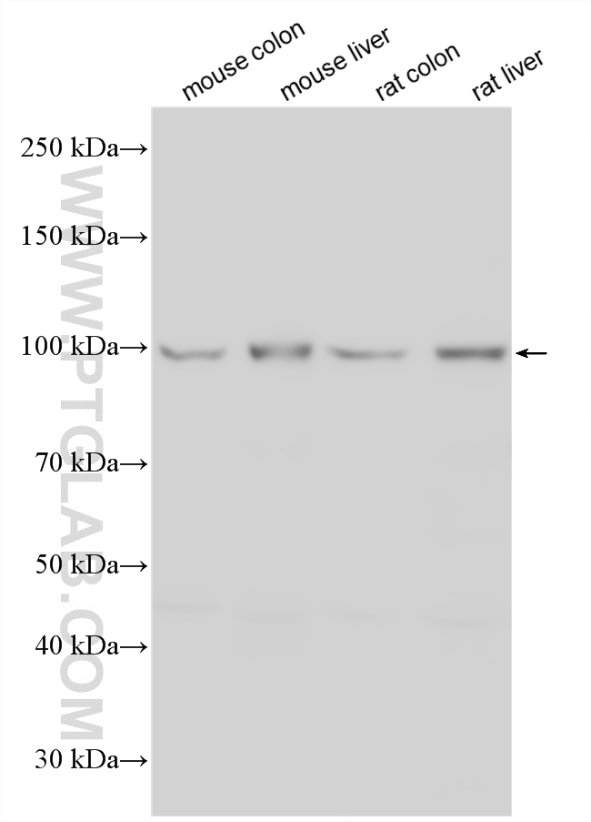 Western Blot (WB) analysis of various lysates using AP1B1 Polyclonal antibody (16932-1-AP)