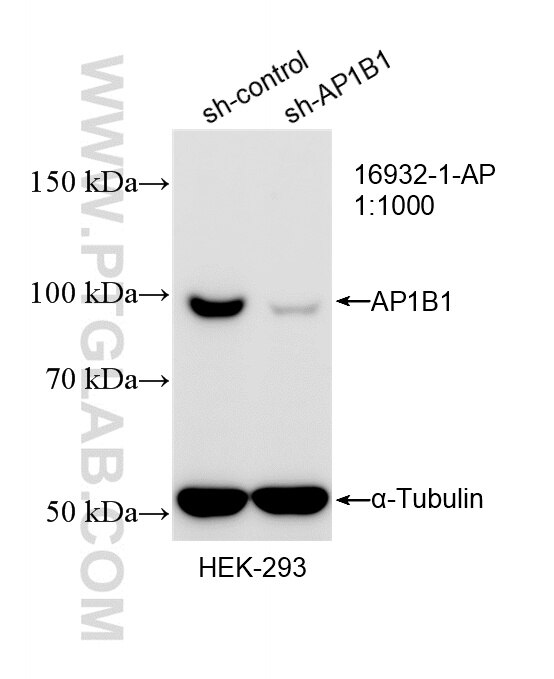Western Blot (WB) analysis of HEK-293 cells using AP1B1 Polyclonal antibody (16932-1-AP)