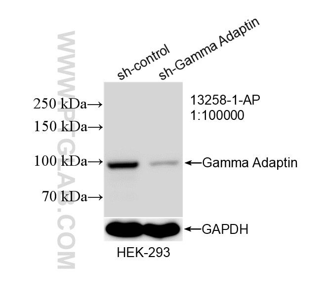Western Blot (WB) analysis of HEK-293 cells using Gamma Adaptin Polyclonal antibody (13258-1-AP)