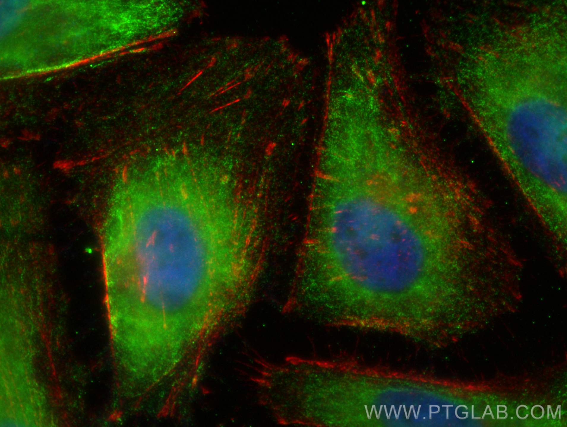 Immunofluorescence (IF) / fluorescent staining of HeLa cells using AP1M1 Monoclonal antibody (68726-1-Ig)