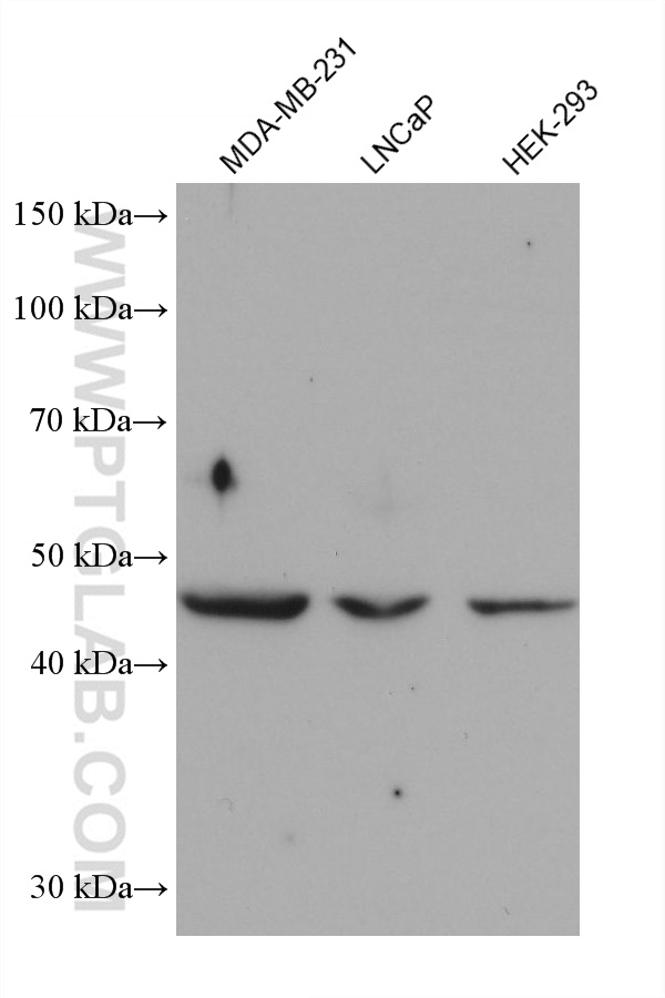 Western Blot (WB) analysis of various lysates using AP1M1 Monoclonal antibody (68726-1-Ig)