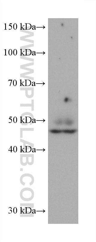Western Blot (WB) analysis of human placenta tissue using AP1M1 Monoclonal antibody (68726-1-Ig)