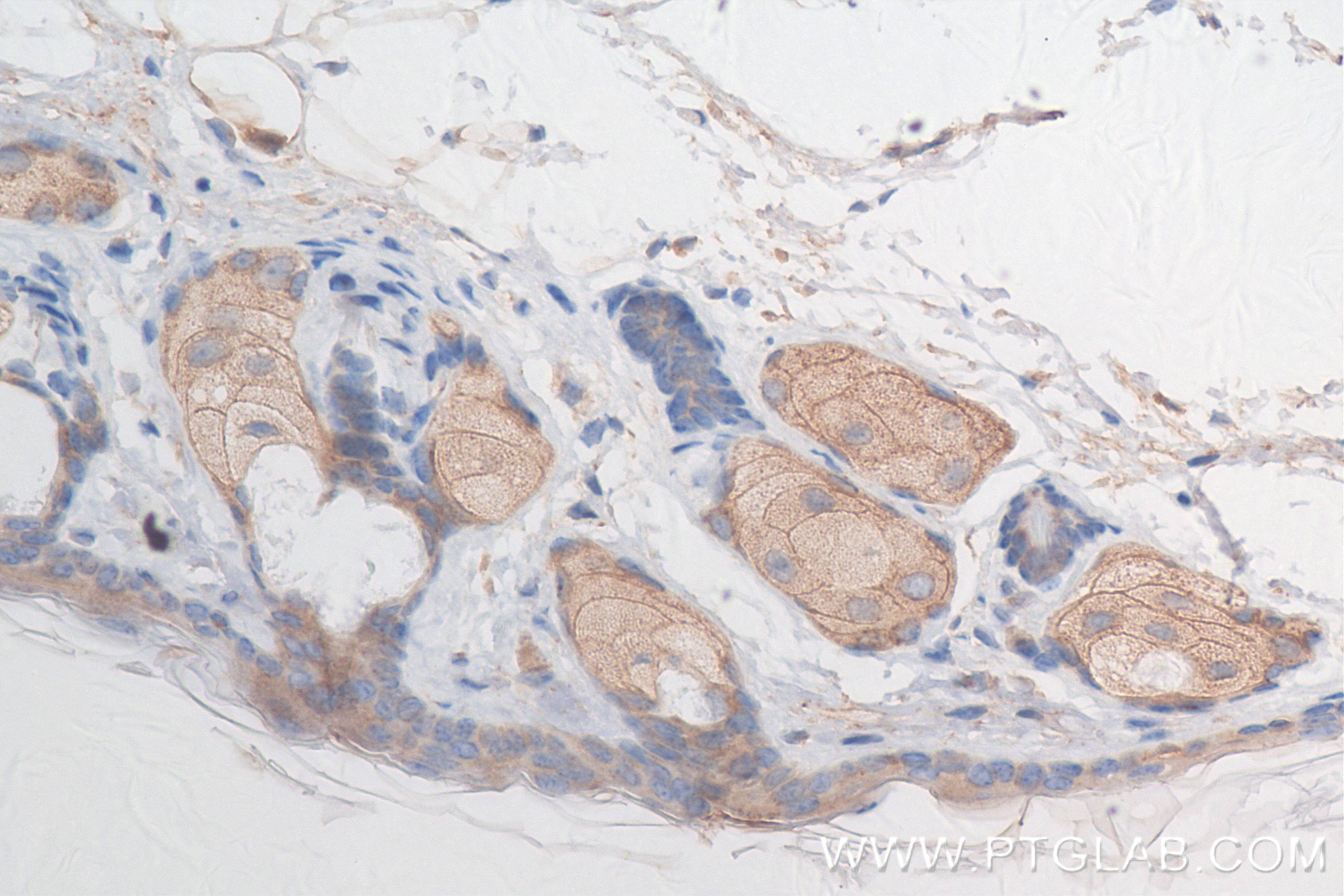 Immunohistochemistry (IHC) staining of mouse skin tissue using AP1M1 Recombinant antibody (83613-6-RR)