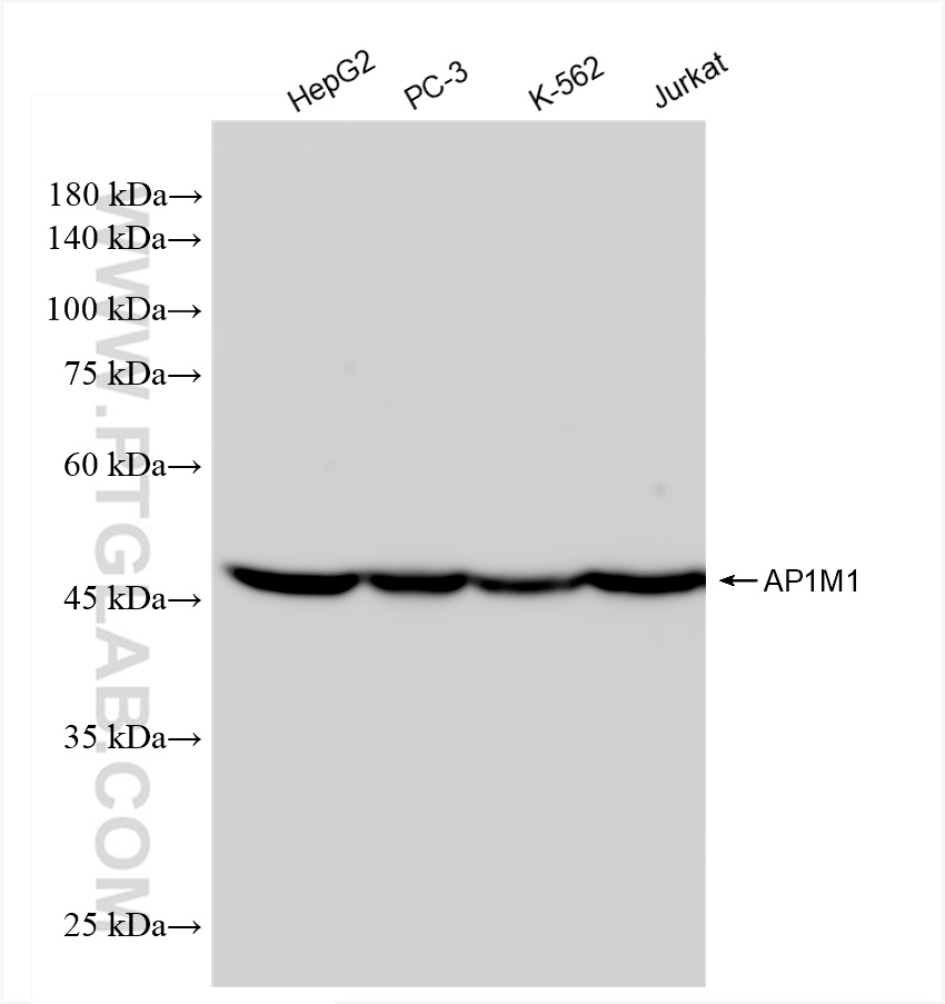 Western Blot (WB) analysis of various lysates using AP1M1 Recombinant antibody (83613-6-RR)