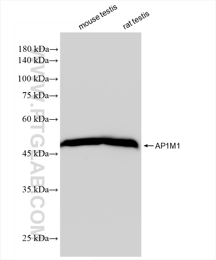 Western Blot (WB) analysis of various lysates using AP1M1 Recombinant antibody (83613-6-RR)