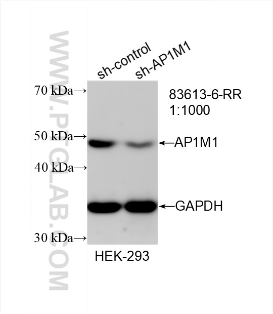 Western Blot (WB) analysis of HEK-293 cells using AP1M1 Recombinant antibody (83613-6-RR)