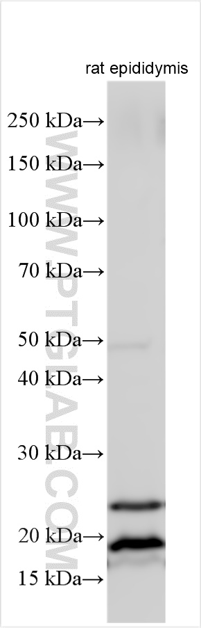 Western Blot (WB) analysis of various lysates using AP1S2 Polyclonal antibody (15043-1-AP)