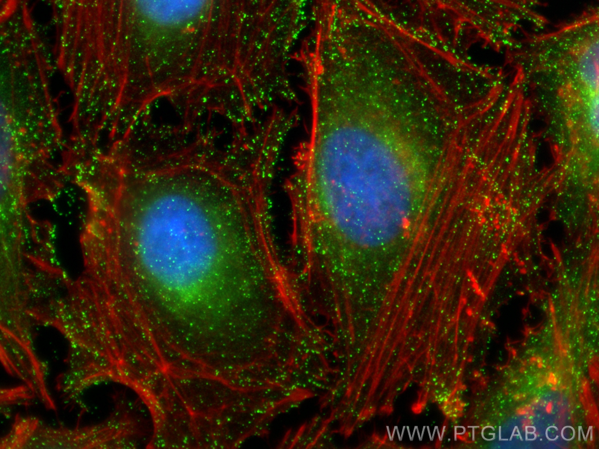 Immunofluorescence (IF) / fluorescent staining of HeLa cells using AP2B1 Polyclonal antibody (15690-1-AP)