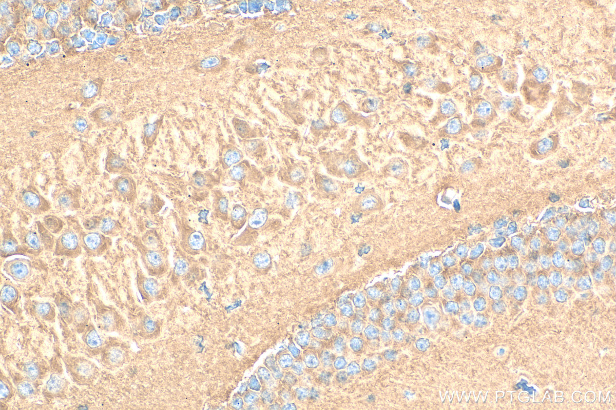 Immunohistochemistry (IHC) staining of mouse brain tissue using AP2B1 Polyclonal antibody (15690-1-AP)