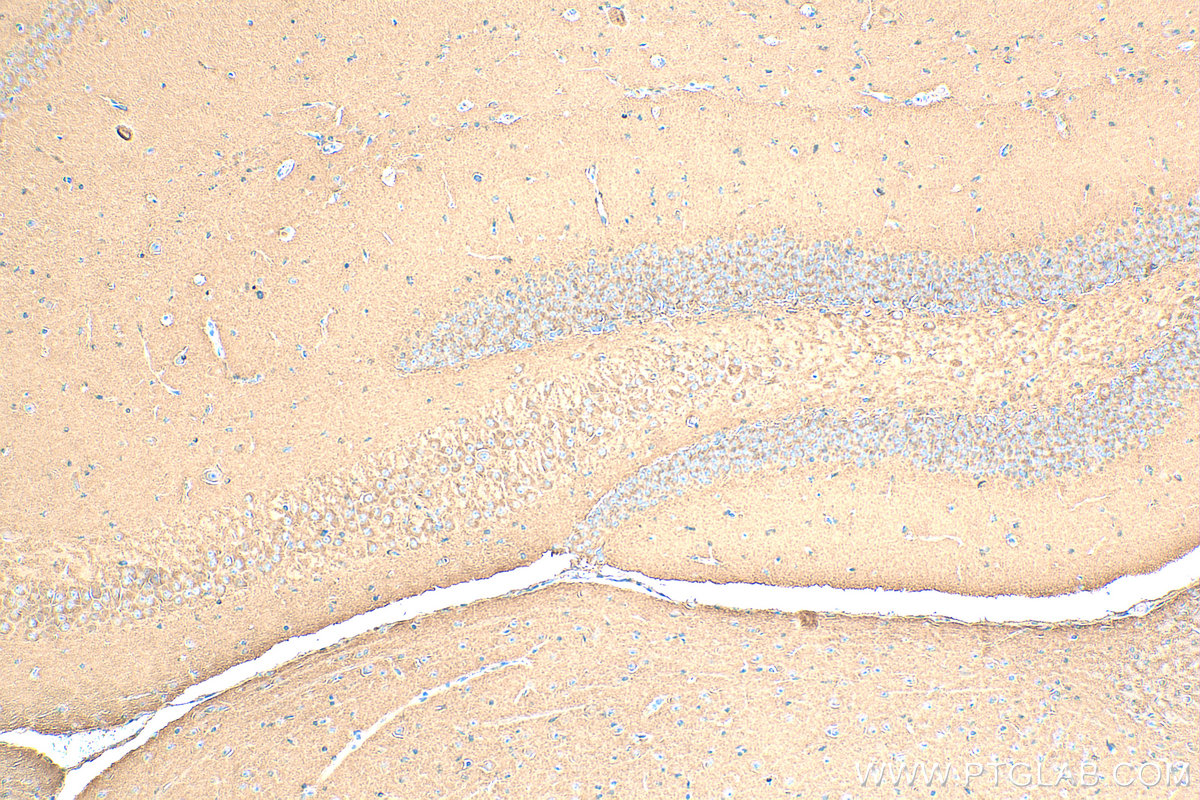 Immunohistochemistry (IHC) staining of mouse brain tissue using AP2B1 Polyclonal antibody (15690-1-AP)