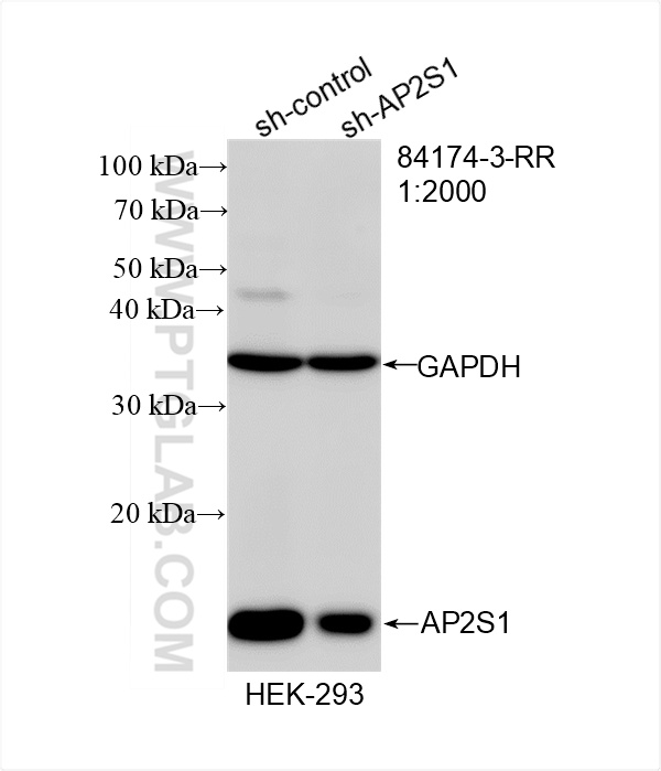 Western Blot (WB) analysis of HEK-293 cells using AP2S1 Recombinant antibody (84174-3-RR)