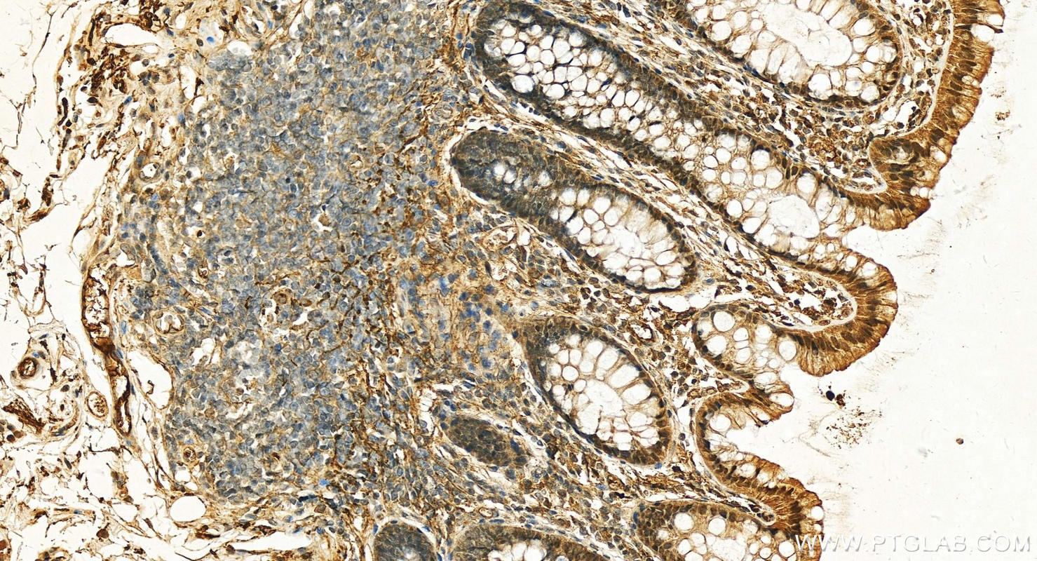 Immunohistochemistry (IHC) staining of human normal colon using Serum amyloid P component Polyclonal antibody (20773-1-AP)