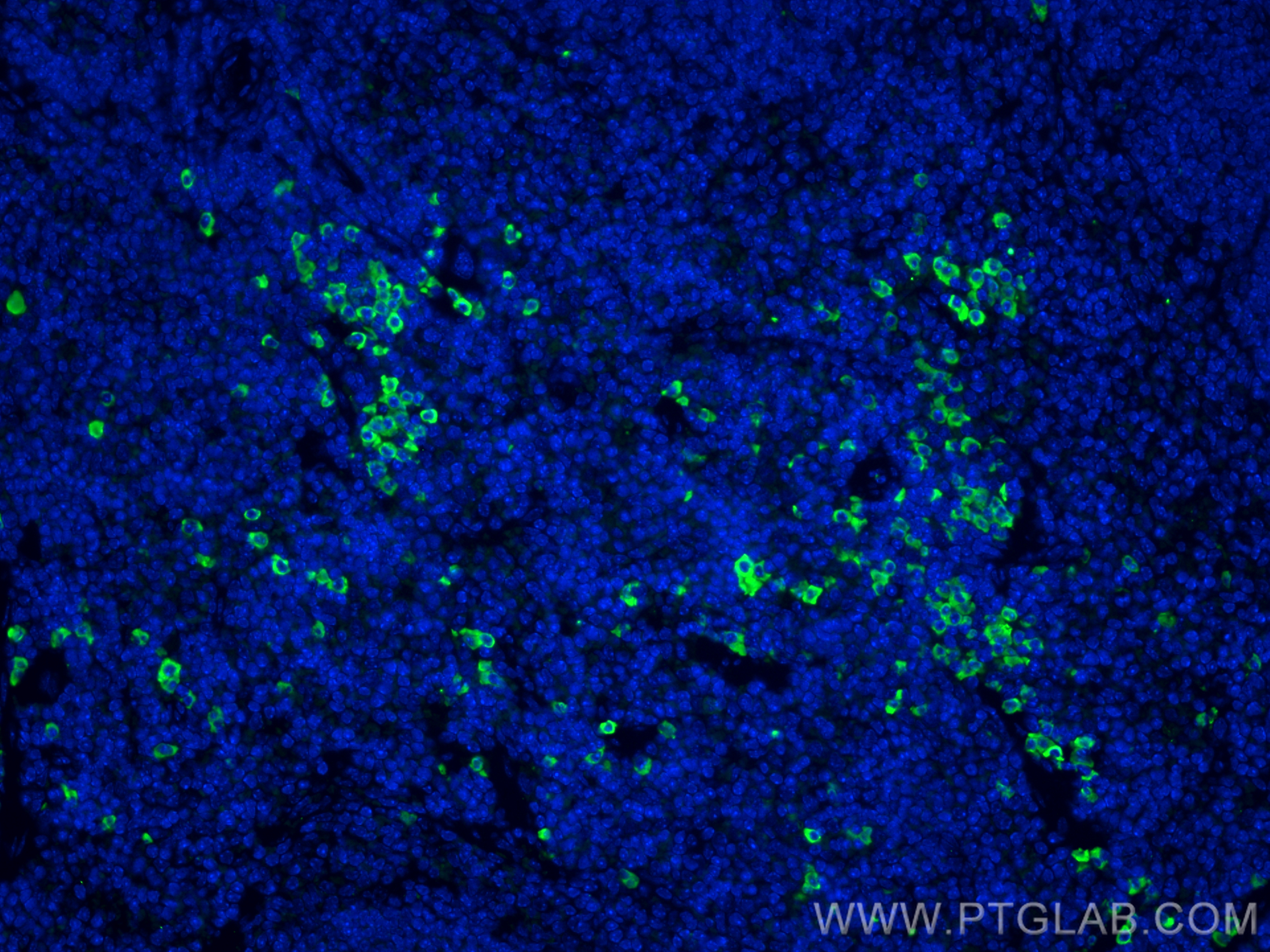 Immunofluorescence (IF) / fluorescent staining of mouse spleen tissue using Serum amyloid P component Monoclonal antibody (66084-1-Ig)