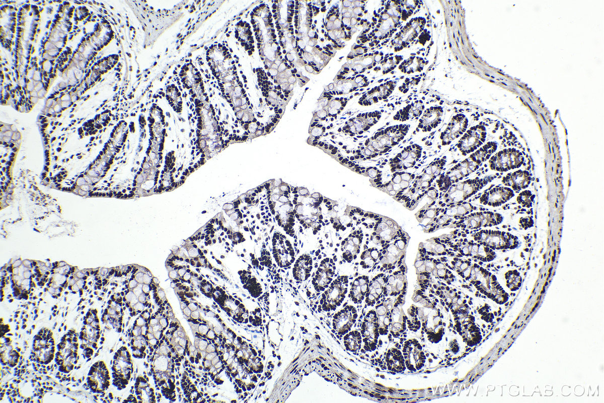 Immunohistochemistry (IHC) staining of mouse colon tissue using APEX1 Polyclonal antibody (10203-1-AP)