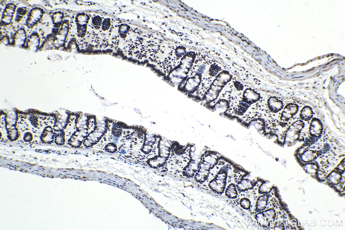 Immunohistochemistry (IHC) staining of rat colon tissue using APEX1 Polyclonal antibody (10203-1-AP)