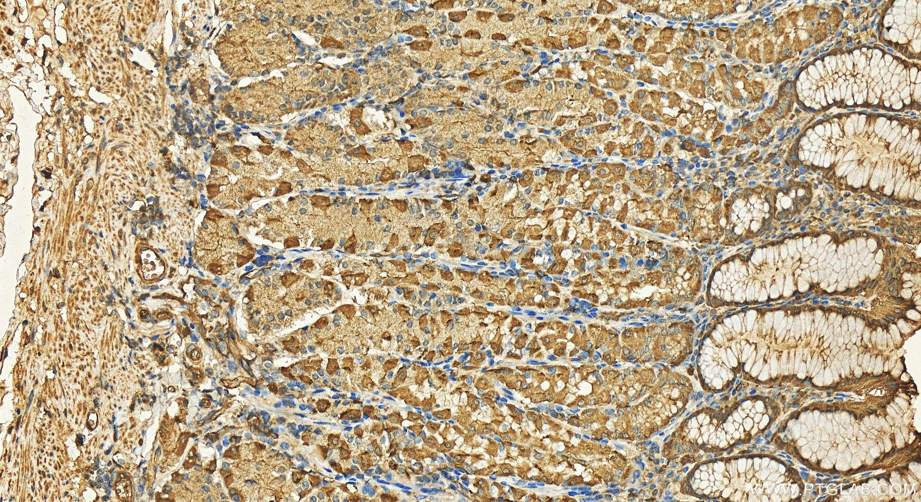 Immunohistochemistry (IHC) staining of human stomach tissue using APH1A Polyclonal antibody (11643-1-AP)