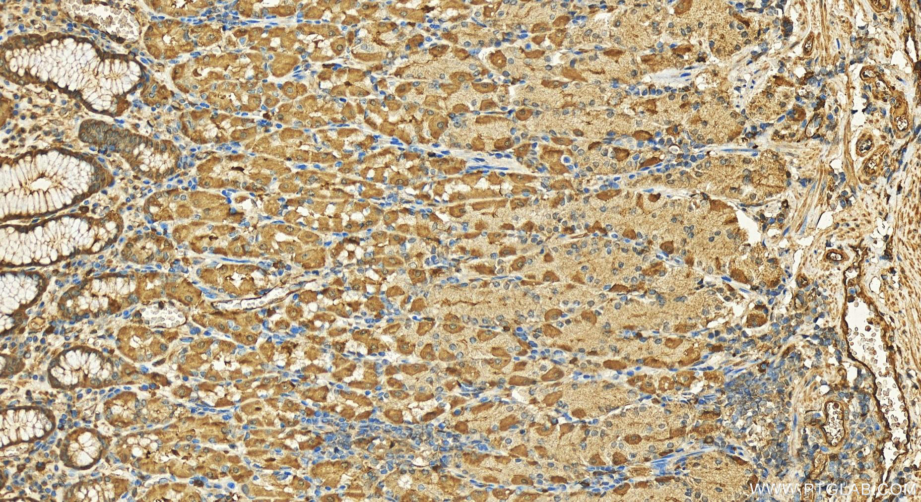 Immunohistochemistry (IHC) staining of human stomach tissue using APH1A Polyclonal antibody (11643-1-AP)