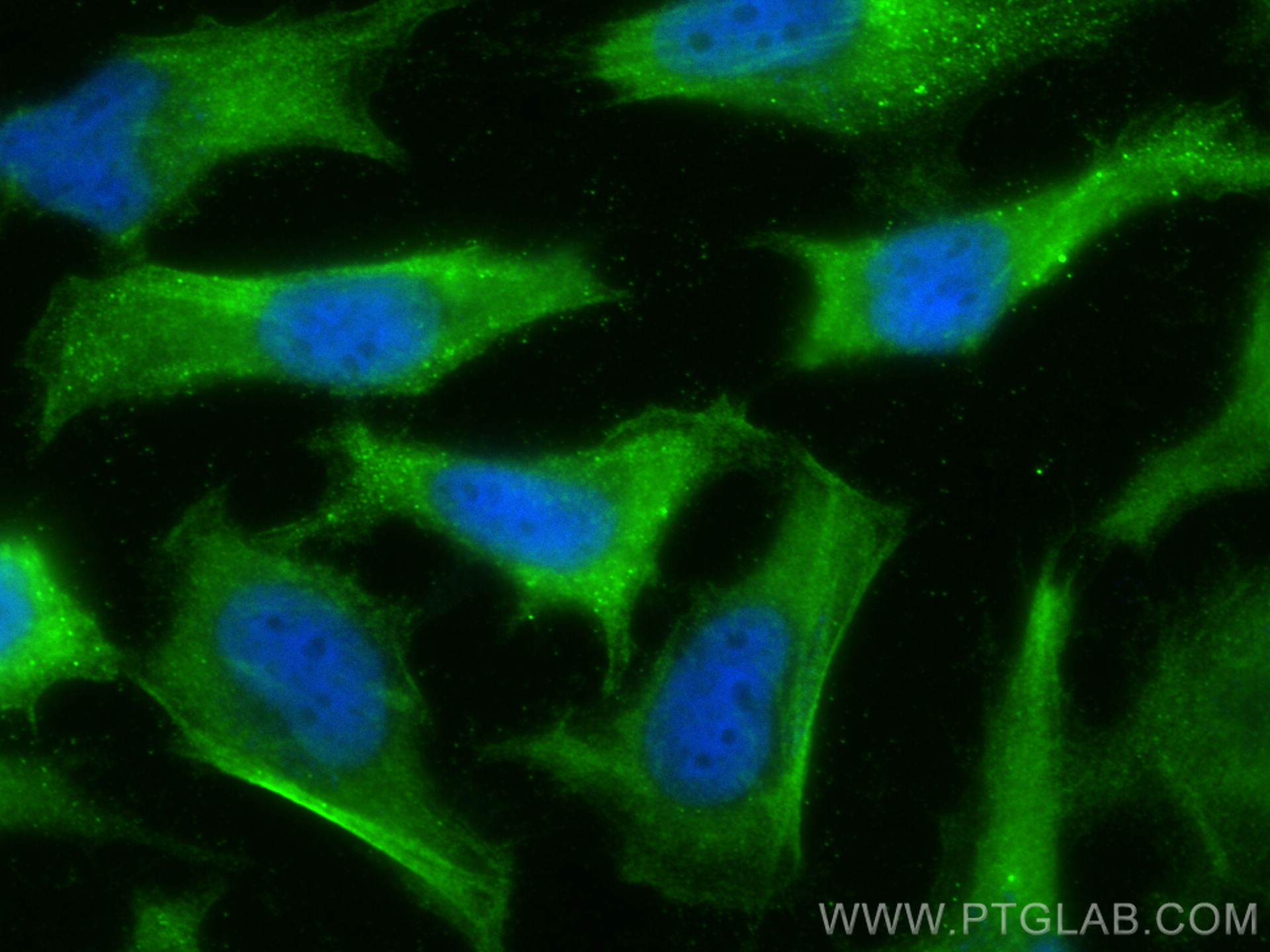 Immunofluorescence (IF) / fluorescent staining of HeLa cells using APH1A Polyclonal antibody (11643-1-AP)